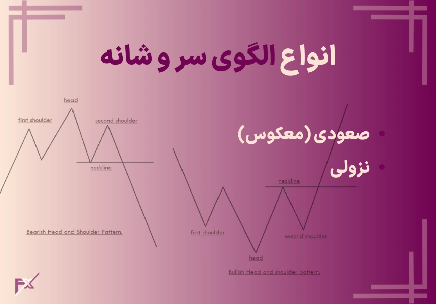 انواع الگوی سر و شانه